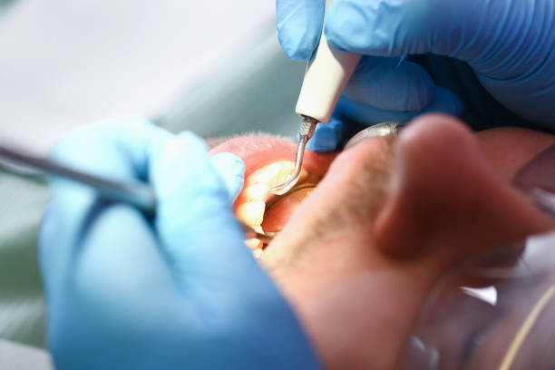 Best Emergency Treatment for Toothache in Hampton, SC
